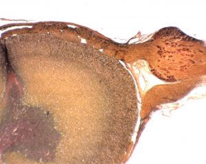 Préparation microscopique moelle + ganglion rachidien