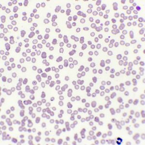 760F Plasmodium dans le sang x400