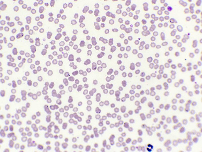 760F Plasmodium dans le sang x400