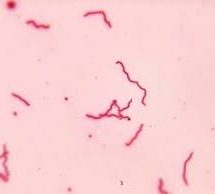 préparation microscopique de borrélia ( Bactéries spiralées)
