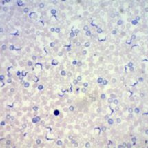 Préparation microscopique Trypanosomes dans le sang