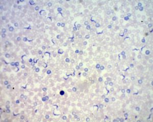 Préparation microscopique Trypanosomes dans le sang