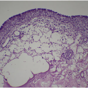 790E Peau réaction inflammatoire