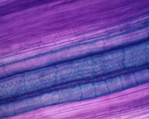 Préparation microscopique de vaisseaux xylème CL (annelés, spiralés, rayés, réticulés)