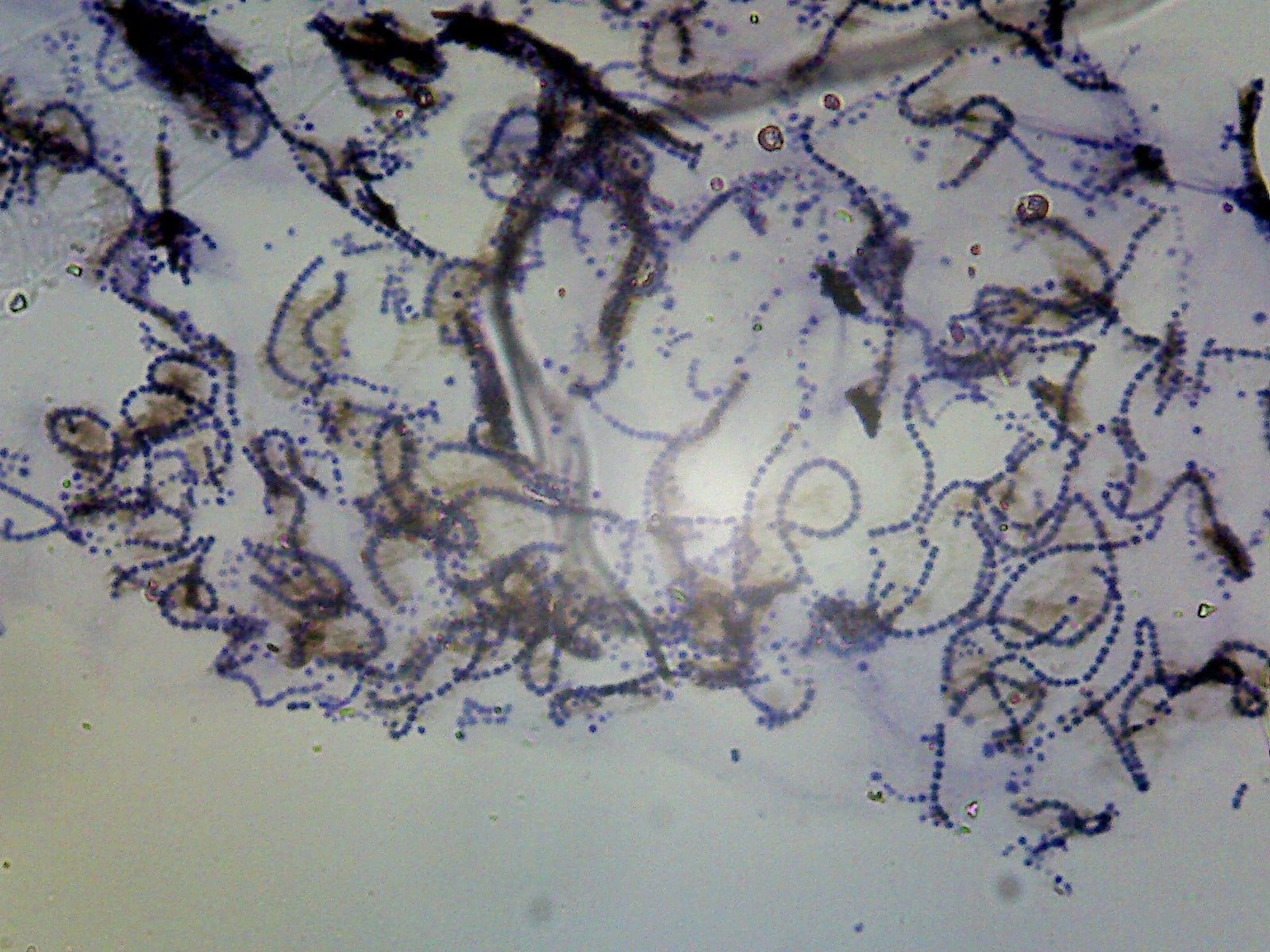 collema lichen gelatineux