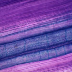 283C - Préparation microscopique de vaisseaux xylème CL (annelés, spiralés, rayés, réticulés)