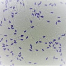842C spermatozoides de taureau 40x