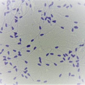 spermatozoides taureau preparation microscopique
