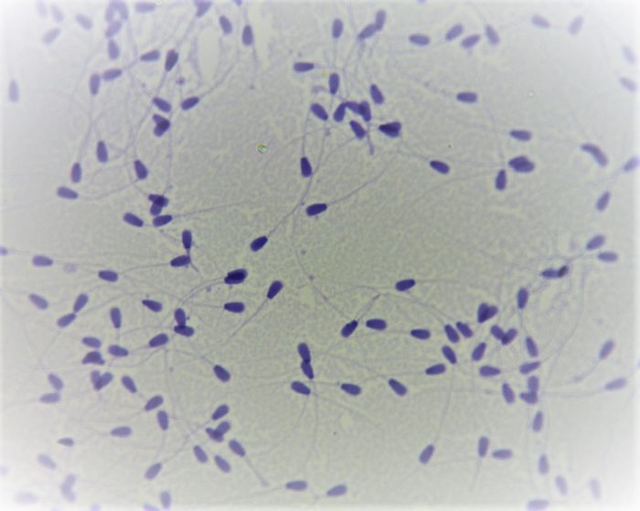 spermatozoides taureau preparation microscopique