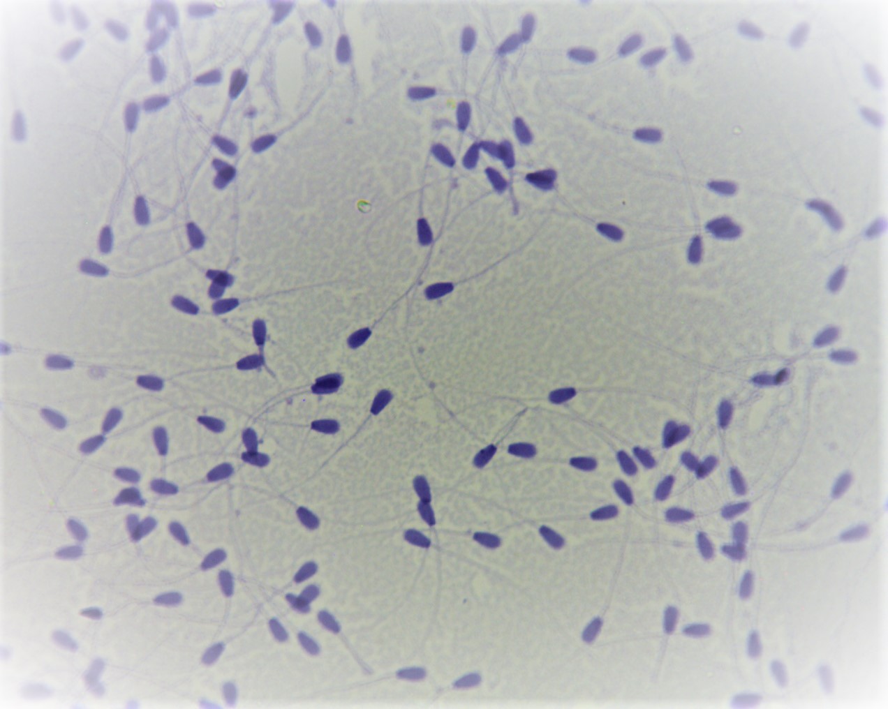 spermatozoides taureau preparation microscopique